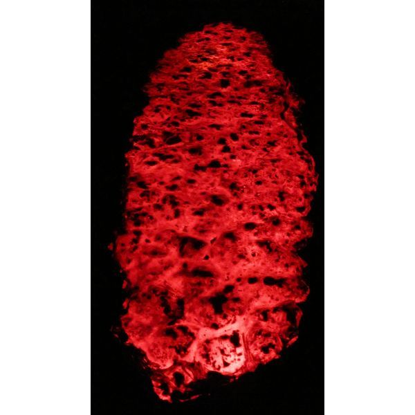 Transformation de l'angoisse